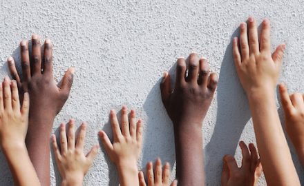 Children's hands against a white wall. Children with Arthrogryposis have joint contractures present at birth. It impacts hands and feet.