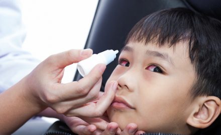 Adult putting drops into eyes of an Asian child with very red eyes.
