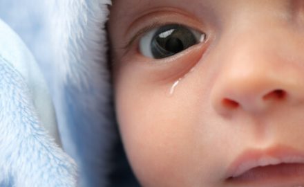 Close-up of a baby with eye drainage.
