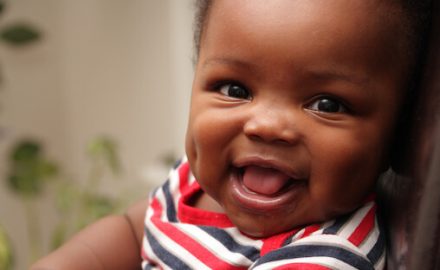 Smiling African American baby boy. Does he have hydrocele?