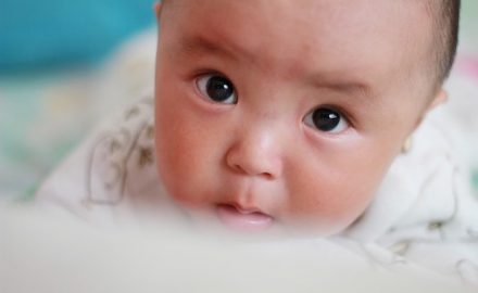 Baby with bright eye. PKU is a genetic condition.