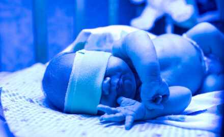 Baby in phototherapy for jaundice in newborn