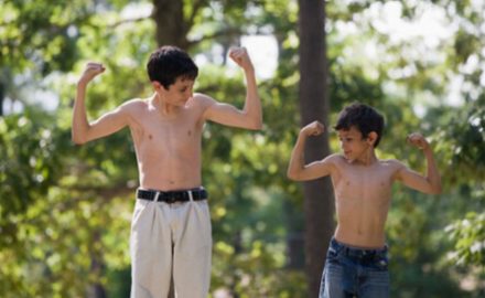 Two boys flexing their muscles in the summer outdoors. Ringworm Look-Alikes