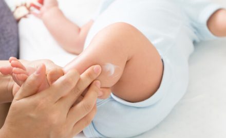 Mother rubbing cream on baby's leg for ringworm treatment.
