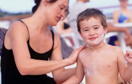 Pediatric Sunburn Treatment & Prevention