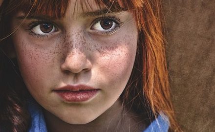 Young redheaded girl with freckles. Could she have anemia?