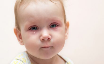 Baby with red, watery eyes. Is it pinkeye or allergies?